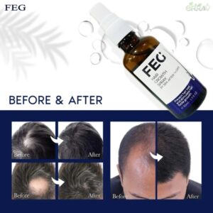 FEG-spray para el crecimiento del cabello, 50mL, precent, estimula el crecimiento del cabello, focile, ownning, cabello más largo, más grueso y más saludable
